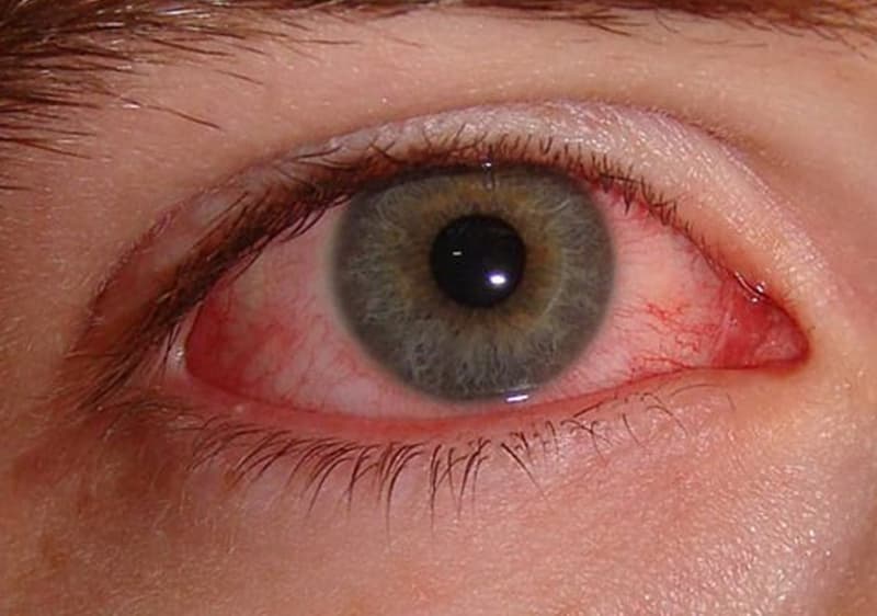 Ojo Rojo
